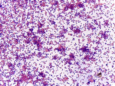 Mikroskobik boyutta boyanmış bakteri görüntüsü, çeşitli şekilleri ve boyutları canlı mor ve pembe bir palette sergiliyor..