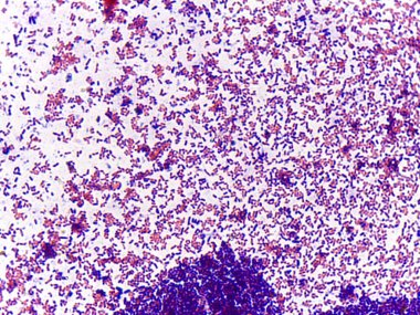 Bir slayttaki mikroskobik bakteri kolonileri görüntüsü, mor lekeli arka planda çeşitli şekil ve boyutları gösteriyor.