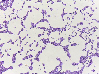 Beyaz zemin üzerinde mor lekeli hücrelerin mikroskobik görüntüsü, hücre yapılarını ve desenlerini gösteriyor