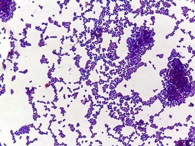 Beyaz zemin üzerinde mor lekeli hücrelerin mikroskobik görüntüsü kümeleri ve dağınık hücreleri gösteriyor, muhtemelen biyolojik bir örnek ya da dokuyu gösteriyor..