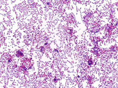 Mikroskobik bakteri görüntüsü, lekeli bir hazırlanmada kümeler ve bireysel hücreleri gösterir