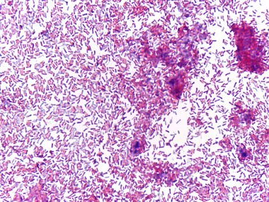 Bakterilerin mikroskobik görünümü, çeşitli şekilleri ve boyutları göstermektedir.
