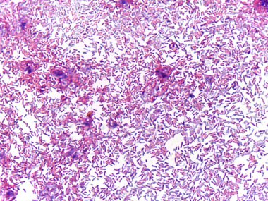 Bakteri kolonilerinin mikroskobik bir görüntüsü, rengarenk bir şekilde çeşitli şekil ve boyutlarda bakteriler sergiliyor.