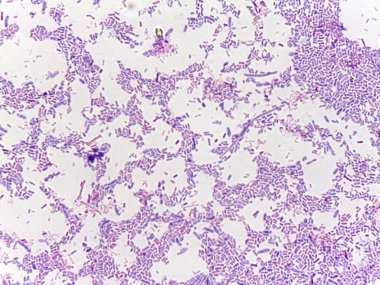 Bir örnekte mikroskobik bakteri görüntüsü, çeşitli şekilleri ve düzenlemeleri gösterir, mor lekeli arka plan