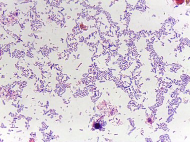 Mikroskobik bakteri görüntüsü, çeşitli şekiller ve düzenlemeler, açık mor bir leke ile hücreleri vurguluyor
