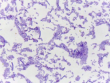 Mor lekeli bir örnekte mikroskobik bakteri kolonileri görüntüsü, çeşitli şekiller ve bakteri düzenleri göstermektedir.