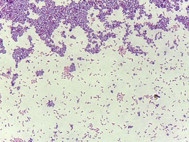 Bir kültür plakası üzerindeki bakteri kolonilerinin mikroskobik görüntüsü, mor lekeli arka planda çeşitli şekil ve boyutlarda bakteri göstermektedir.