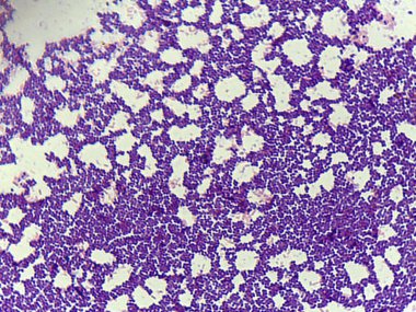 Mor lekeli dokunun mikroskobik görüntüsü, hücresel yapıları ve desenleri gösteriyor