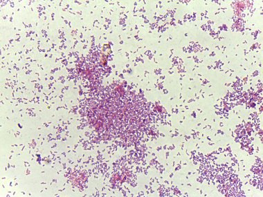 Mor ve pembe renklerle boyanmış çeşitli şekil ve boyutlara sahip bakteri kolonilerinin mikroskobik görüntüsü farklı bir mikrop topluluğunu gösteriyor.