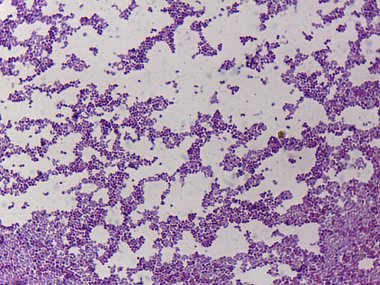 Mor lekeli hücreli dokunun mikroskobik görüntüsü, yoğun hücresel yapısını gösteriyor, muhtemelen biyolojik bir örnek ya da histolojik bölümü gösteriyor.