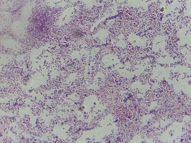 Bakterilerin mikroskobik görünümü, mor lekeli arka planda kümeler ve bireysel hücreleri gösterir