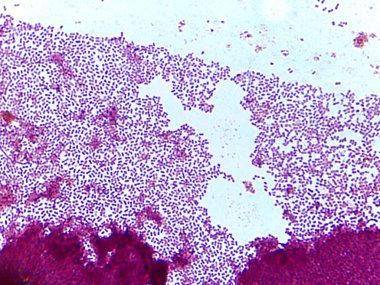 Bir slayttaki mikroskobik bakteri kolonileri görüntüsü, daha hafif bir arka plana karşı yoğun, mor lekeli hücreler kümesini gösterir