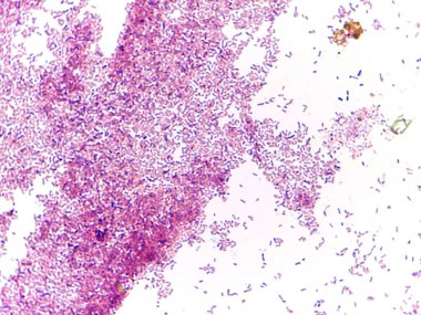 Mikroskobik bir görünüm farklı şekil ve boyutlara sahip lekeli bir numunede bakteri ve diğer mikroorganizmaları gösteriyor.