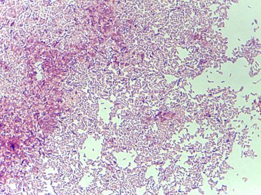 Mikroskobik bakteri kolonilerinin görülebilirlik için çeşitli şekilleri ve düzenlemeleri gösteren bir slayttaki görüntüsü