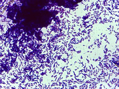 Bakterilerin mikroskobik görüntüsü, mor lekeli arka planda çok sayıda çubuk şekilli organizmaları gösteriyor.