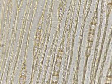 Genişletilmiş hücrelerin şeffaf bir arka planı olan mikroskobik görünümü, hücresel yapıları ve desenleri gösterir