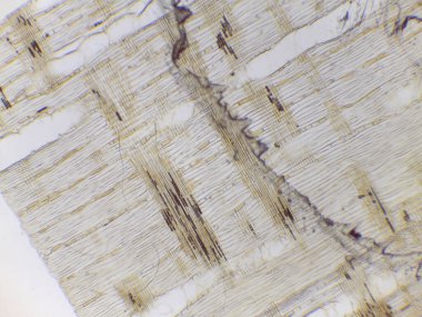 Hücre yapısı ve lifleri gösteren bitki dokusunun mikroskobik görüntüsü