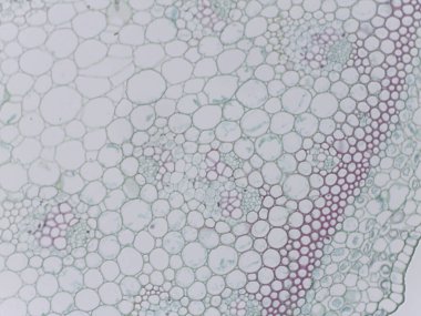 Hücre duvarları ve hücreler arası boşluklara odaklanarak çeşitli şekil ve boyutları gösteren mikroskobik bir görünüm.