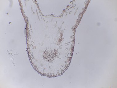Hücresel yapıyı gösteren mikroskobik görüntü, muhtemelen kök ucu ya da kök kesiti, farklı hücre çizgileri ve damar dokusuyla