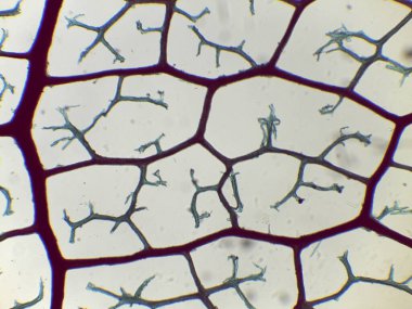 Bir hücre ağının mikroskobik görüntüsü, dallanan yapılar, hücresel desen gibi