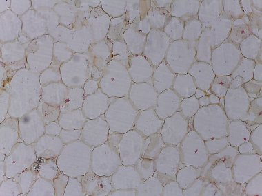 Düzensiz şekiller ve açık renklerle, muhtemelen biyolojik dokuyu ya da benzer bir maddeyi betimleyen, hücresel yapıları andıran dokuya yakın bir görüntü.