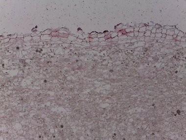 Cilt dokusunun mikroskobik görüntüsü hücre katmanlarını, üst deri ve deriyi, görünür hücre yapılarını ve boyama etkilerini gösteriyor.