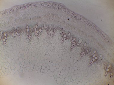 Çeşitli hücre tiplerini ve yapıları gösteren bitki dokusunun mikroskobik görünümü