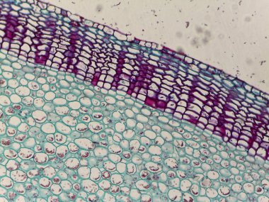 Mor ve mavi lekeli hücre yapısını gösteren mikroskobik bitki dokusu görüntüsü