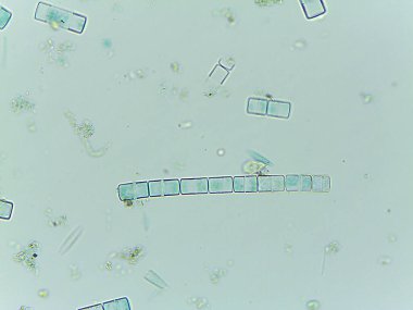 Auxospore oluşumunu gösteren mikroskobik Diatom Melosira Görünümü.