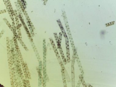 Mikroskobik Yeşil Yosun Görünümü, Spirogyra, Spiral Kloroplastlar