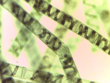 Mikroskobik Yeşil Yosun Görünümü, Spirogyra, Spiral Kloroplastlar