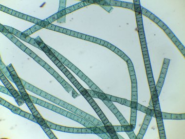 Çoklu Spirogyra İplikleri 'nin mikroskobik Görünümü Segmentli Hücreleri ve Spiral Kloroplastları Gösteriyor