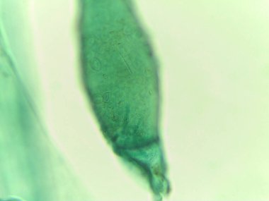 Mikroskobik Yeşil Yosun Görünümü, Pithophora, Akinetes Gösterimi