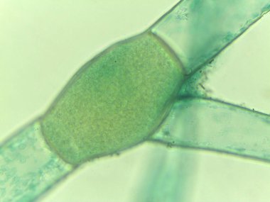 Mikroskobik Yeşil Yosun Görünümü, Pithophora, Akinetes Gösterimi