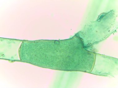 Mikroskobik Yeşil Yosun Görünümü, Pithophora, Akinetes Gösterimi