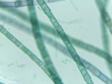 Potansiyel Cüce İplikçikleri ile mikroskobik Filamentous Algler (Oedogonium) Görünümü