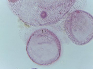 Koloni Yeşil Algası 'nın mikroskobik görüntüsü, Volvox, Kız Kolonileri Gösteriliyor