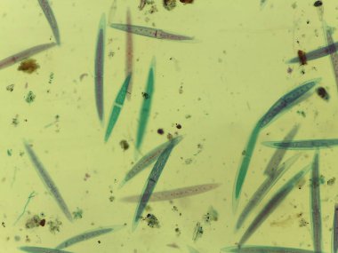 Hilal Şeklinde Yeşil Alglerin (Dolap İplikleri) Mikroskobik Alanı