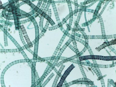 Filamentous Yeşil Alglerin Mikroskobik Görünümü, Ulothrix