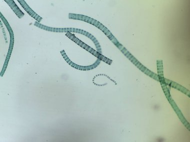 Filamentous Yeşil Alglerin Mikroskobik Görünümü, Ulothrix