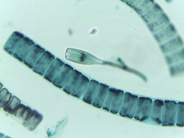Filamentous Yeşil Alglerin Mikroskobik Görünümü, Ulothrix