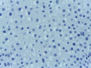 Anafaz mikrografı, kardeş kromatidlerin bir bitki hücresindeki zıt kutuplara çekildiğini gösteriyor.