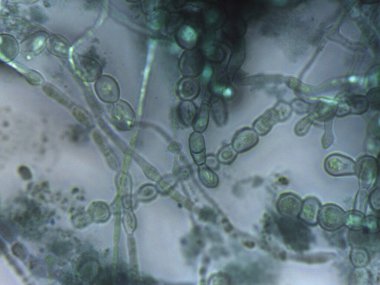 Yoğun bir ağda iç içe geçmiş septik ve dematiasöz mantar hifabesini gösteren mikrograf.