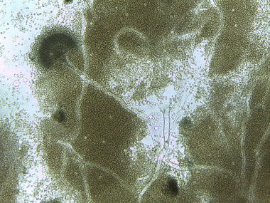 Mikroskobik Aspergillus konidiyoforları, ortama bol miktarda spor salar..