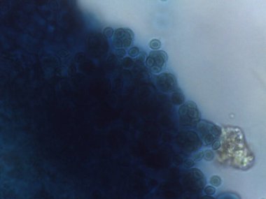 Büyük, mavi lekeli, kalın duvarlı mantar üreme veya dinlenme yapısını gösteren mikrograf..