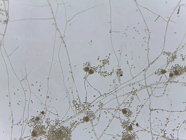 Penisilyum küf fırça benzeri konidiyoforun ve oval sporların mikroskobik görüntüsü.