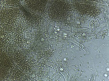Mikroskobik Aspergillus konidiyoforları, ortama bol miktarda spor salar..