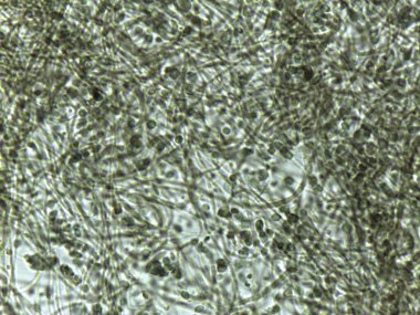 Kalın duvarlı, septik hyphae ve dematiaceous mantar parçalarını gösteren mikrograf..