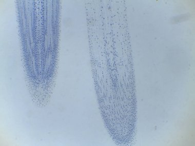 Anafaz mikrografı, kardeş kromatidlerin bir bitki hücresindeki zıt kutuplara çekildiğini gösteriyor.