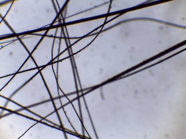 Birbirlerine dolanmış keratin liflerini gösteren mikrograf, muhtemelen kedi kılından, büyütülmüş..